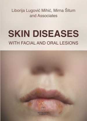 SKIN DISEASES WITH FACIAL AND ORAL LESIONS